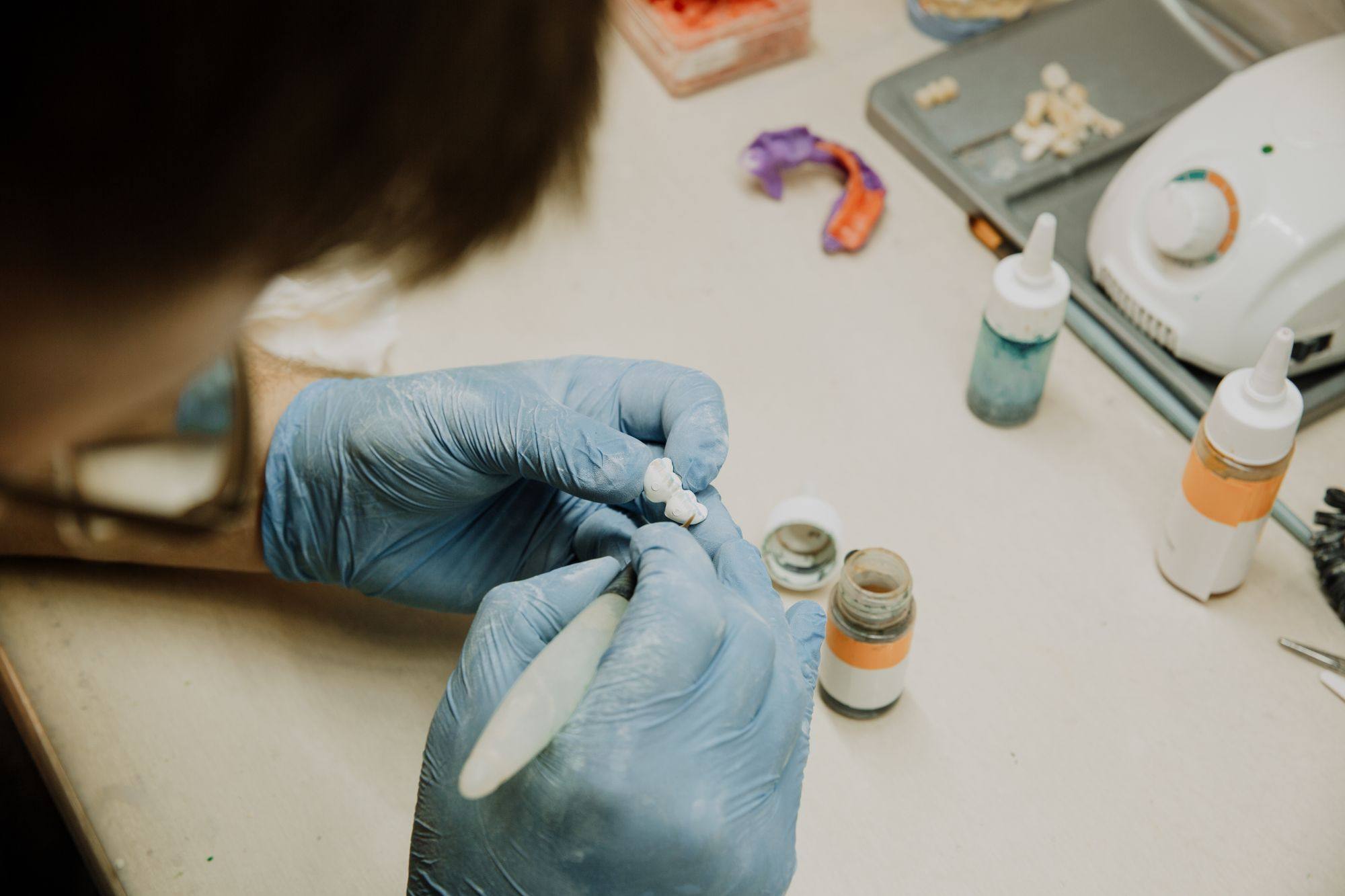 Técnico revisando una prótesis dental con guantes