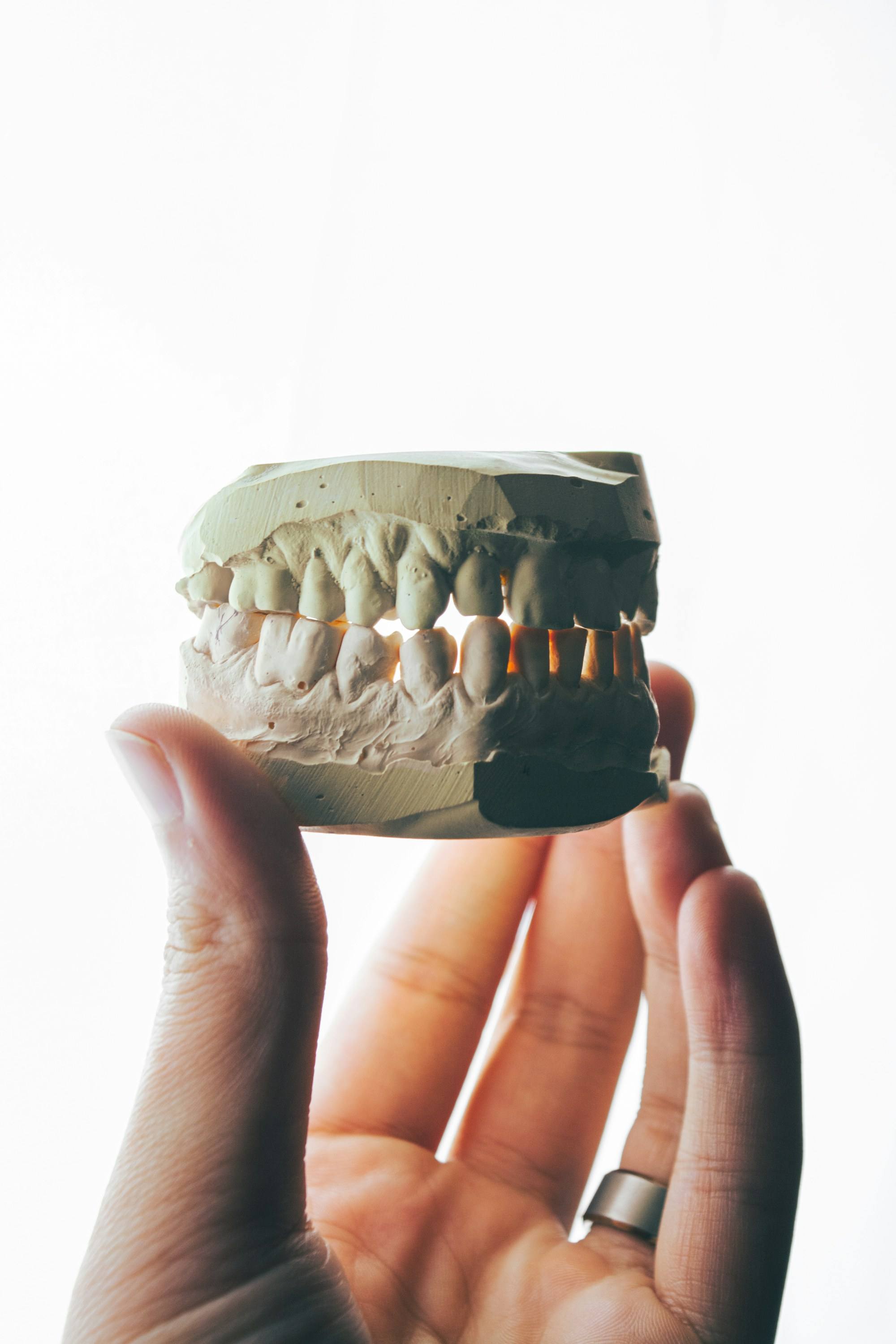 Mano sosteniendo un modelo dental blanco